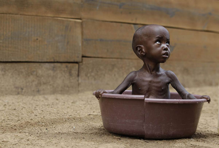 ss-110712-africa-famine-002_ss_f.jpg