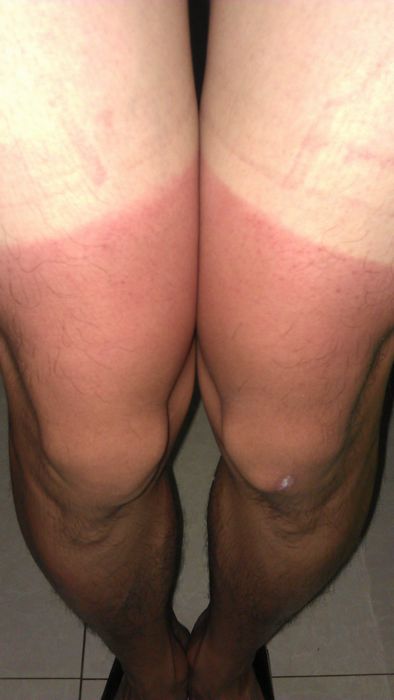 这只是外伤 真正的内伤在屁股和蛋部 那我就不放图了 想要的线下联系我哈哈哈 ...