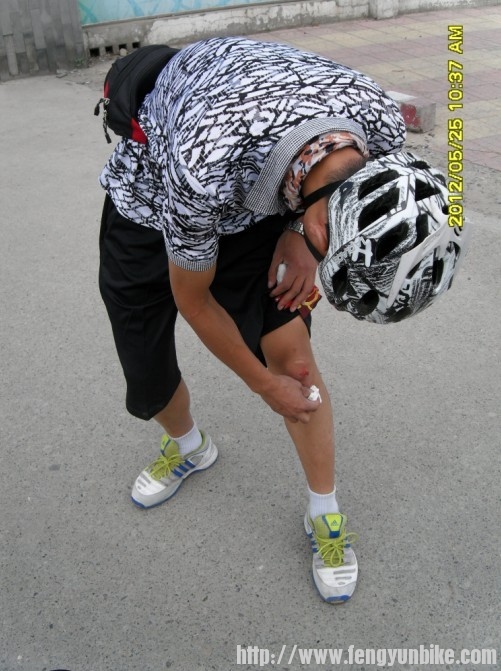 摔破了腿.jpg