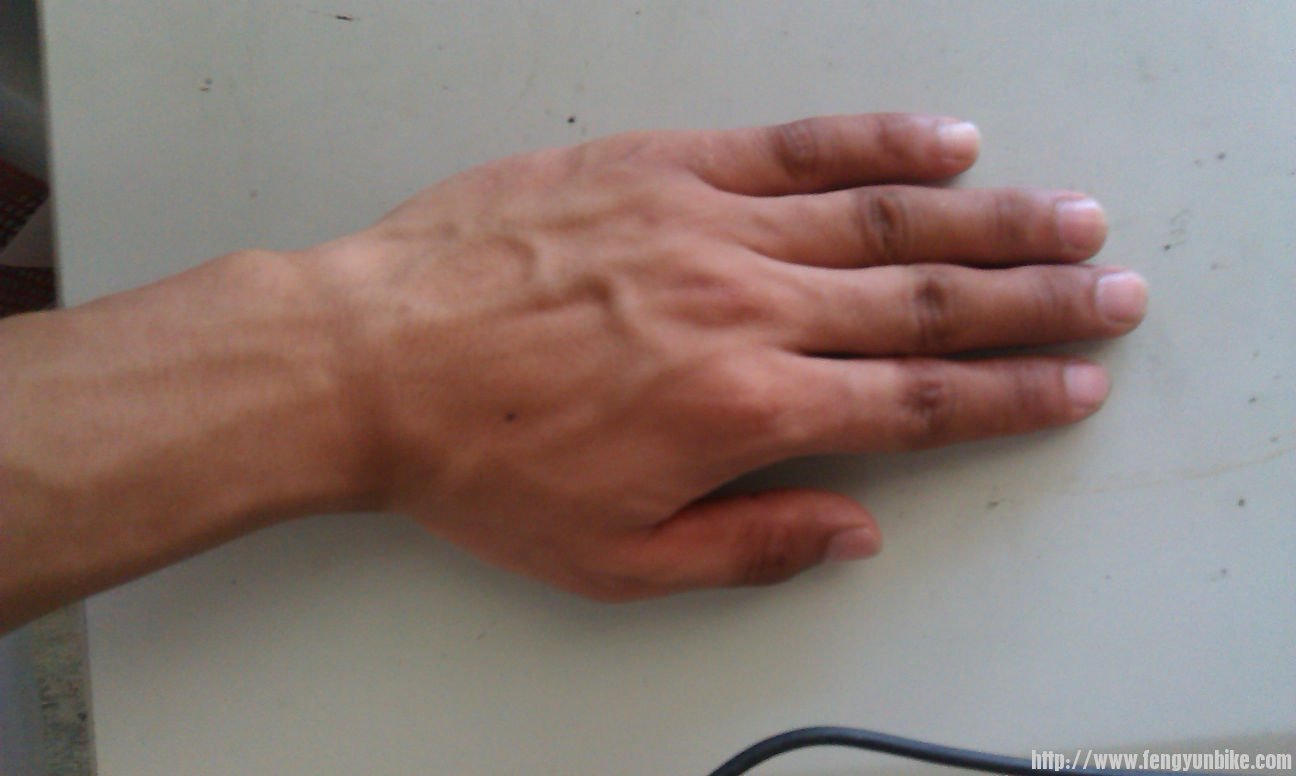 半指手套对照组