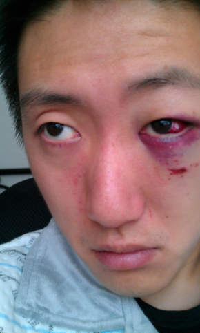 不戴头盔的后果