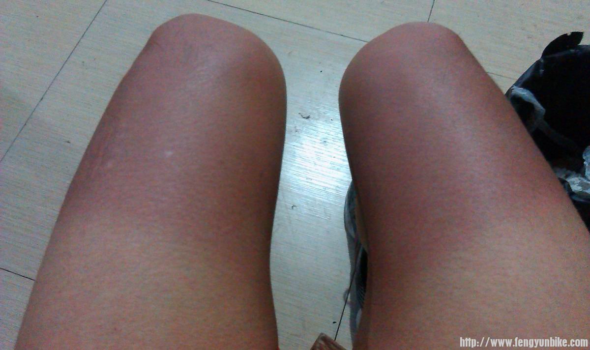 晒黑的腿虽然涂了防晒爽