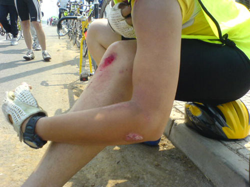 5月14日比赛号号又受伤啦！