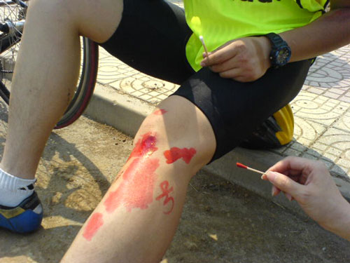 5月14日比赛号号又受伤啦！