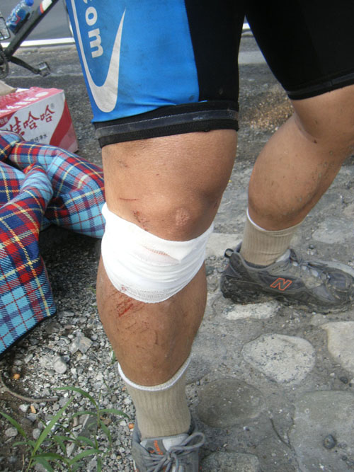 豪总轻伤不下火线 坐在他回来的车中 那是一辆接一辆的超啊 